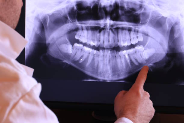 Best Walk-In Emergency Dentist in Polk City, FL